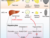 脂肪肝治疗重大进展: JVID
卢玺峰博士科研团队发现调节脂代谢及能量代谢的关键基因