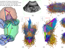 JVID
倪东教授团队在《Medical Image Analysis》上发表文章