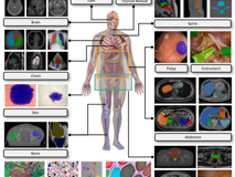 JVID
倪东教授团队在《Medical Image Analysis》上发表文章