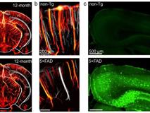 JVID
沈圆圆副教授团队在eBioMedicine发表医学超声在神经退行性疾病的成像与治疗研究成果