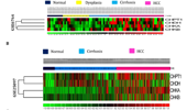 The transcriptional dysregulation of choline catabolism genes was implicated in HCC stage-specific carcinogenesis